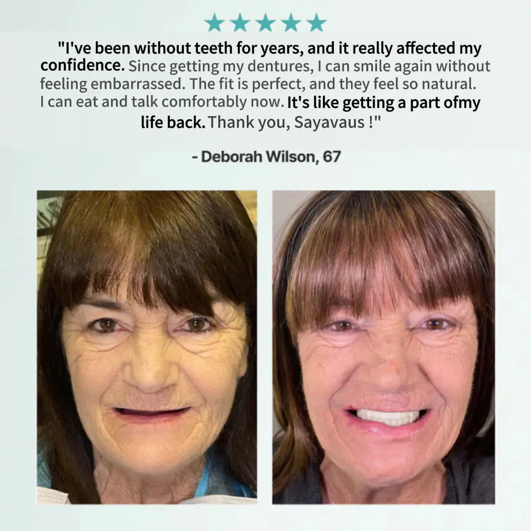 2026 NEW Upgraded 2.0🏆🌎Ends Today: 70% OFF! ⏰SAYAVAUS™ Medical Full Denture with Strong Suctiond🦷Obtain American Dental Association (ADA) Certification