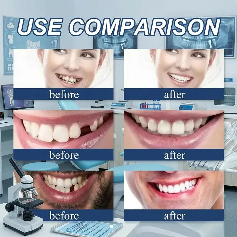 2026 NEW Upgraded 2.0🏆🌎Ends Today: 70% OFF! ⏰SAYAVAUS™ Medical Full Denture with Strong Suctiond🦷Obtain American Dental Association (ADA) Certification