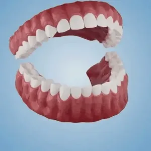 🌎Ends Today: 70% OFF! ⏰SAYAVAUS™Custom-Fit Instant Smile Dentures – Natural Looking Comfort Fit