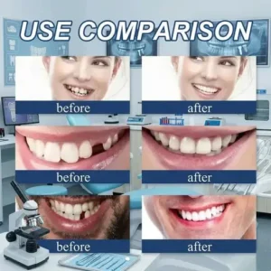 🌎Ends Today: 70% OFF! ⏰SAYAVAUS™Custom-Fit Instant Smile Dentures – Natural Looking Comfort Fit