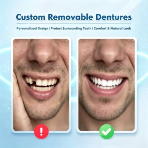 🌎Ends Today: 70% OFF! ⏰SAYAVAUS™Custom-Fit Instant Smile Dentures – Natural Looking Comfort Fit